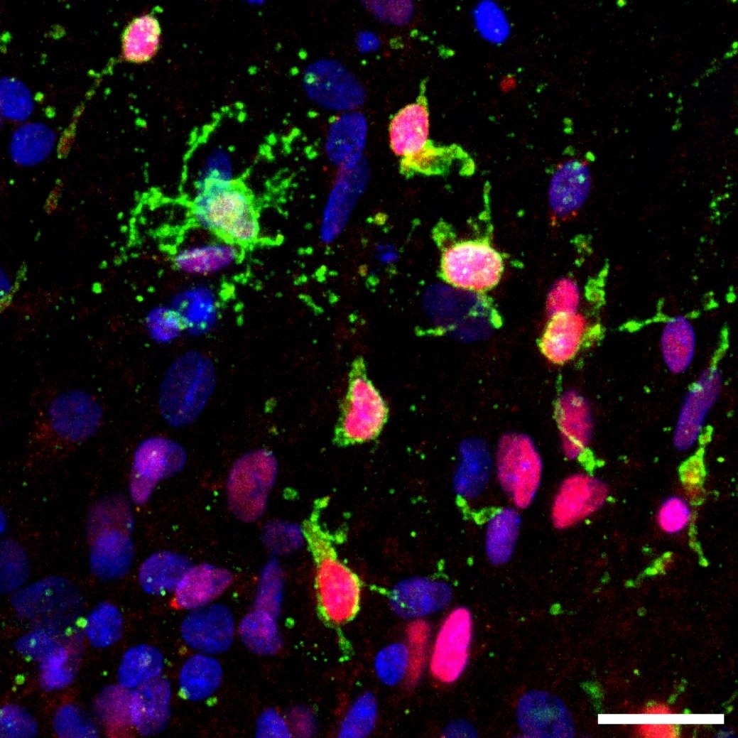 Human Oligodendrocytes In A Dish Green Produce The Protein Which Causes Alzheimers Disease