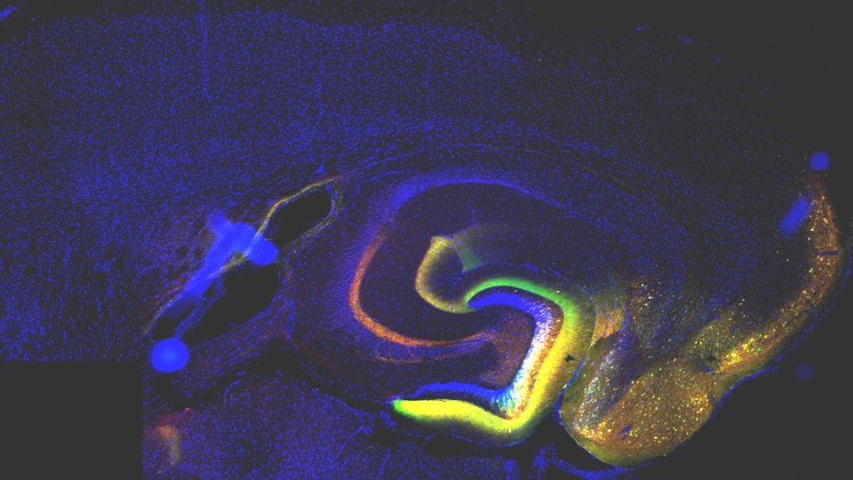 A mouse brain immunofluorescence 