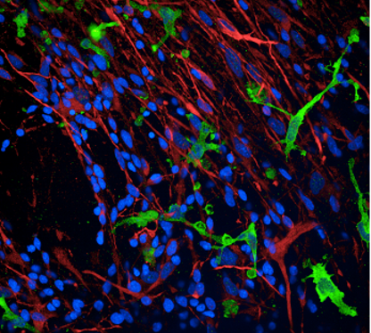 Neurons and microglia 