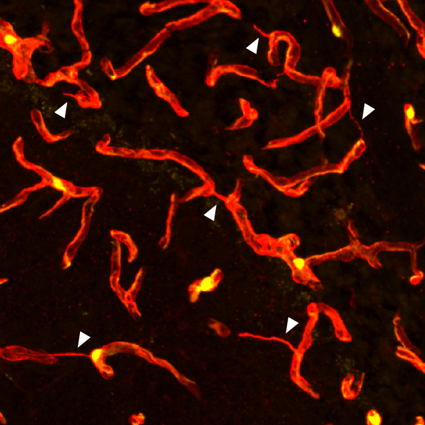 Microscopy showing blood vessels