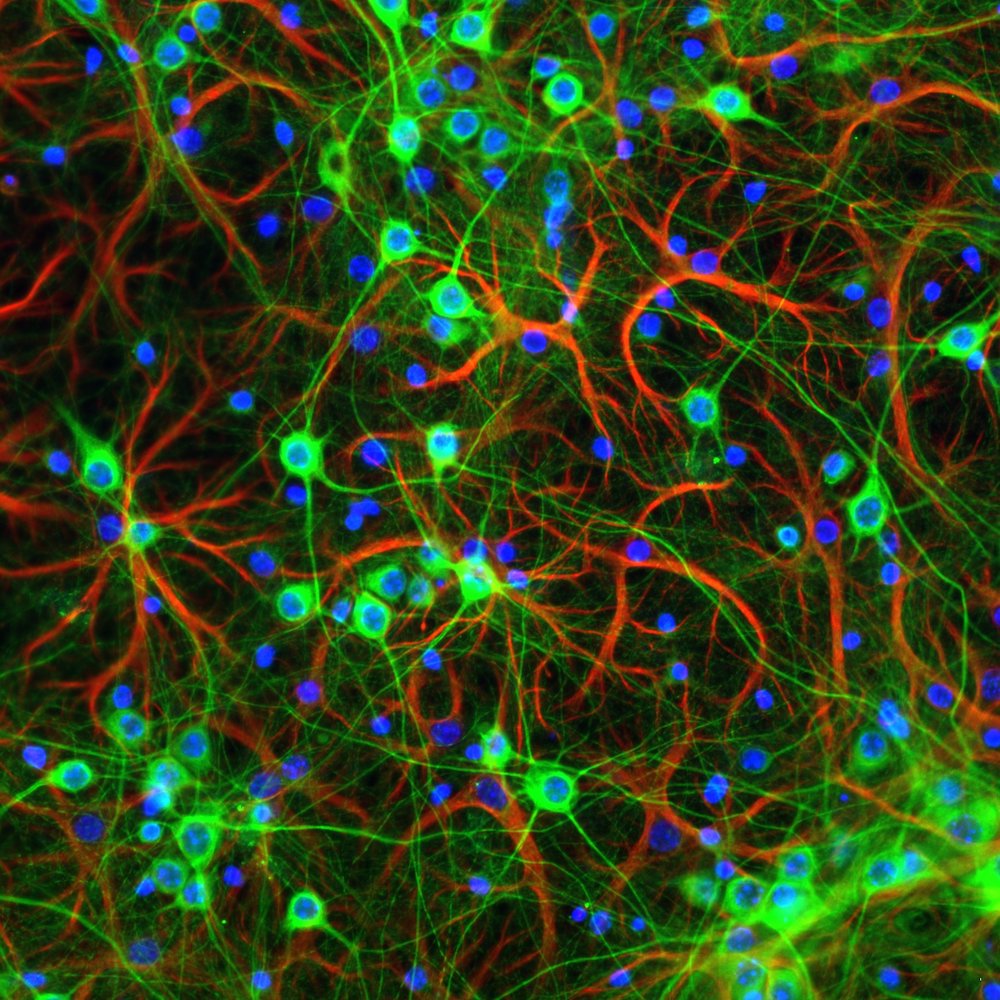 Close up of GFAP MAP2 neurons. credit sophie sanford