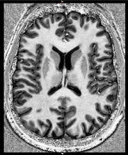 Image of a ultra-high field MRI scan