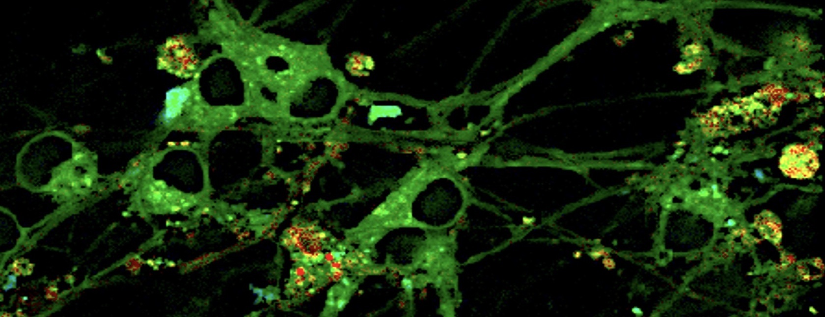 Image of endoplasmic reticulum of a live cell 