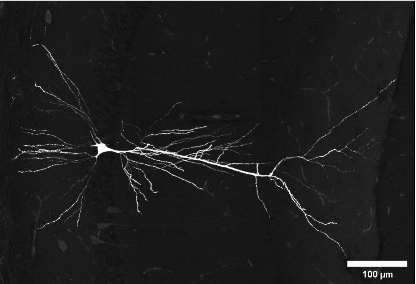 Image showing a pyramid cell in white