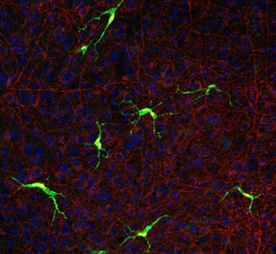 A fluorescence microscopy image of brain tissue showing green-labeled microglia with branching processes against a background of red and blue stained cellular structures.