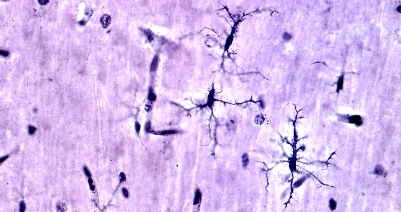 Microglia