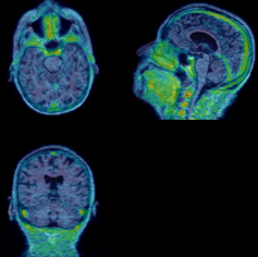 PET tracer imaging from the Bartels Lab