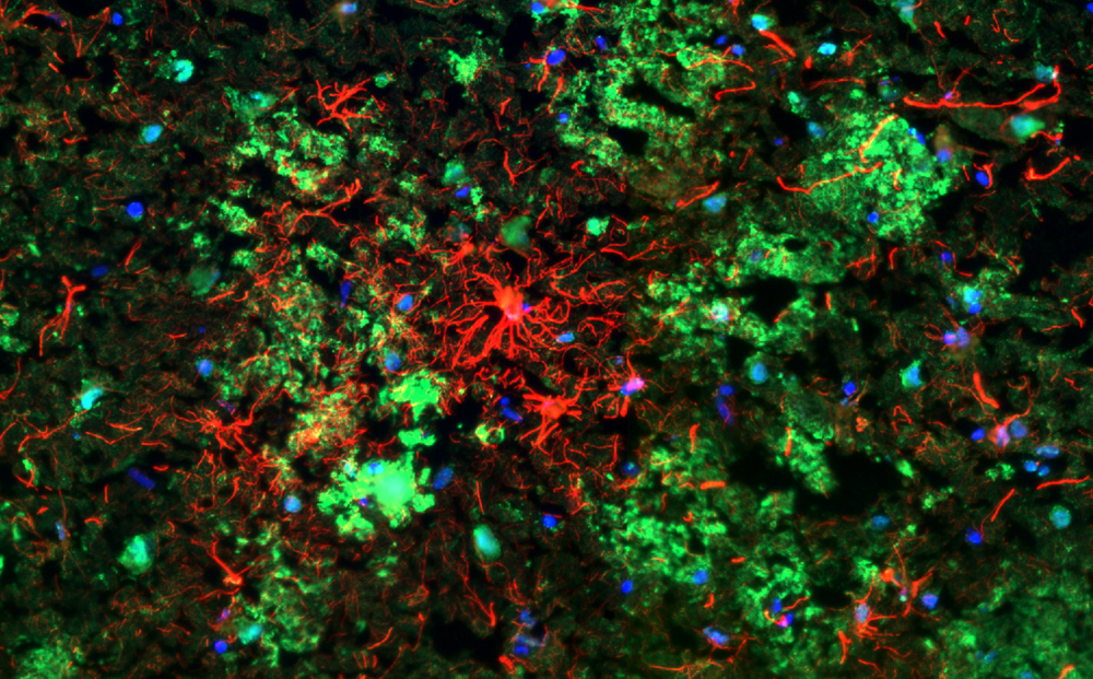 Microglia and astrocyte cells