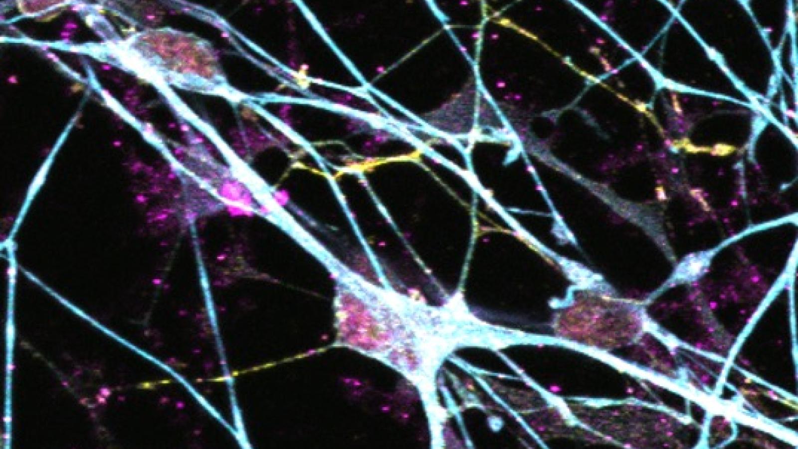 Human iPSC neurons from researcher Jamie Toombs