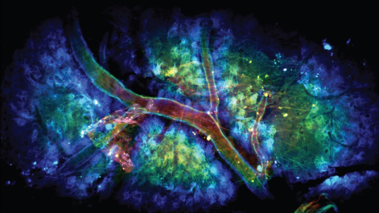 Astrocytes on the brain surface