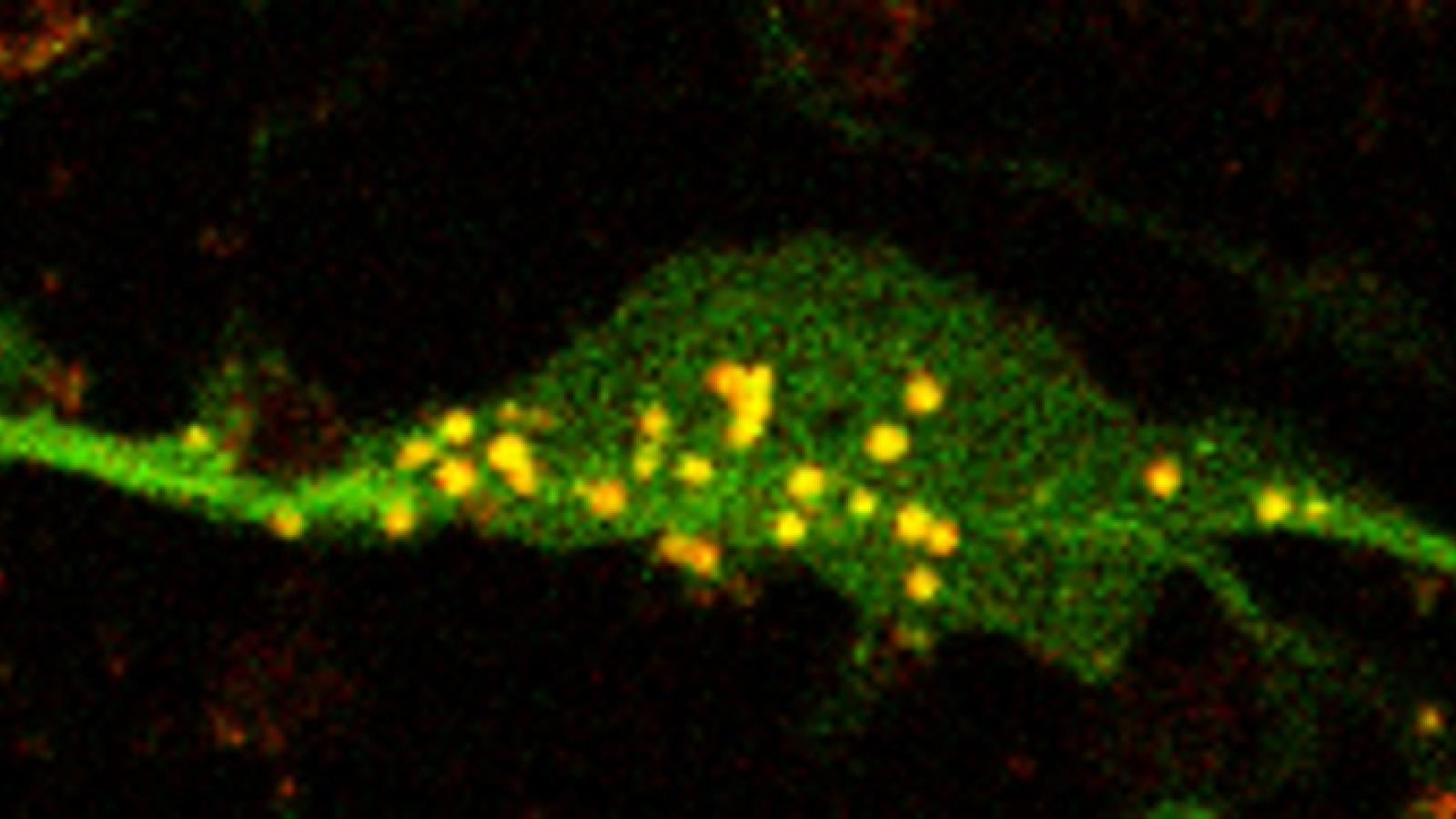 Autophagosome microscopy image - David Rubinsztein