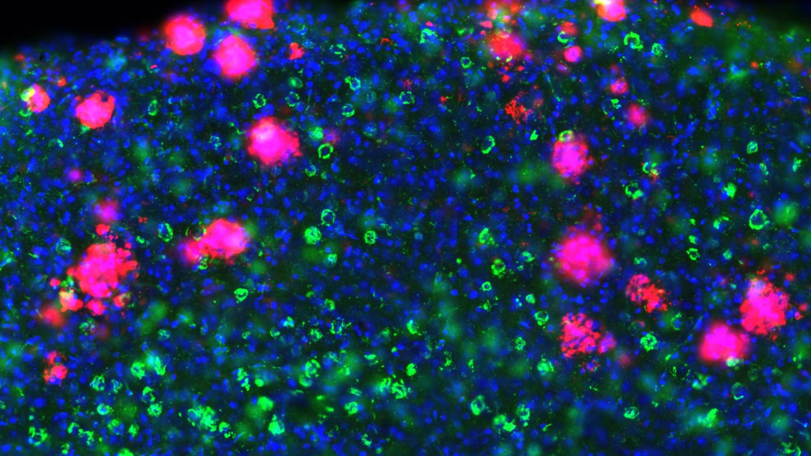 Plaques and tangles in cortex in vitro