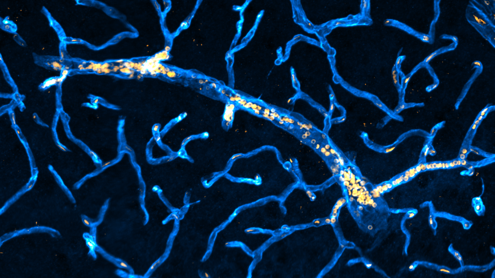 Congestions Montagne Lab