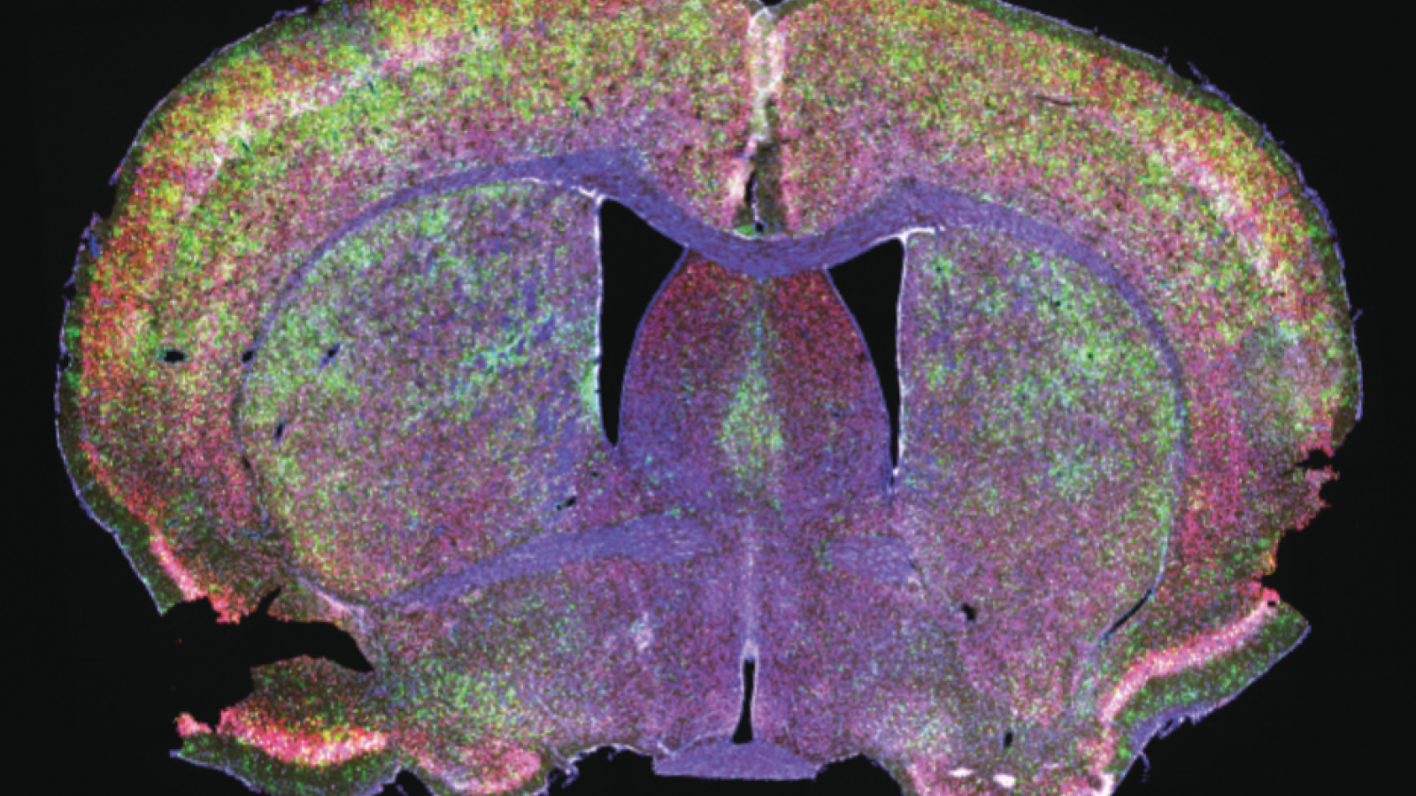 Fluorescence to label different cells and structures of a brain