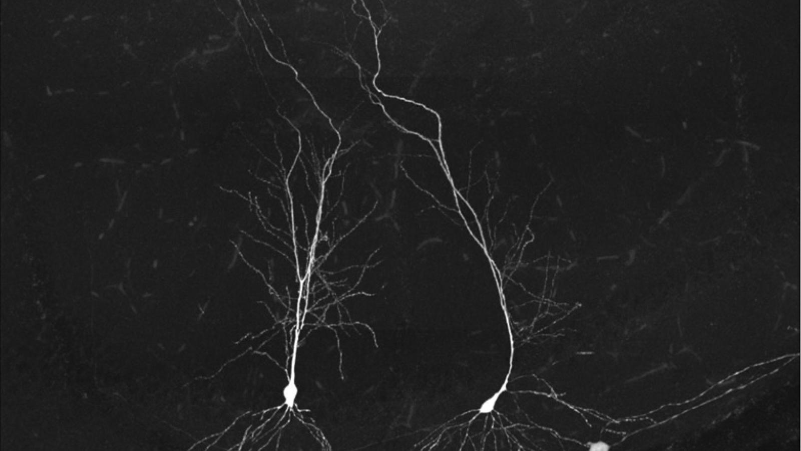Image of neurons