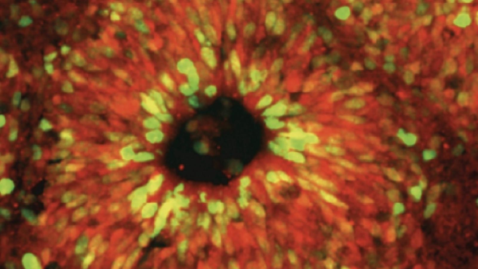 Image of a brain organoid