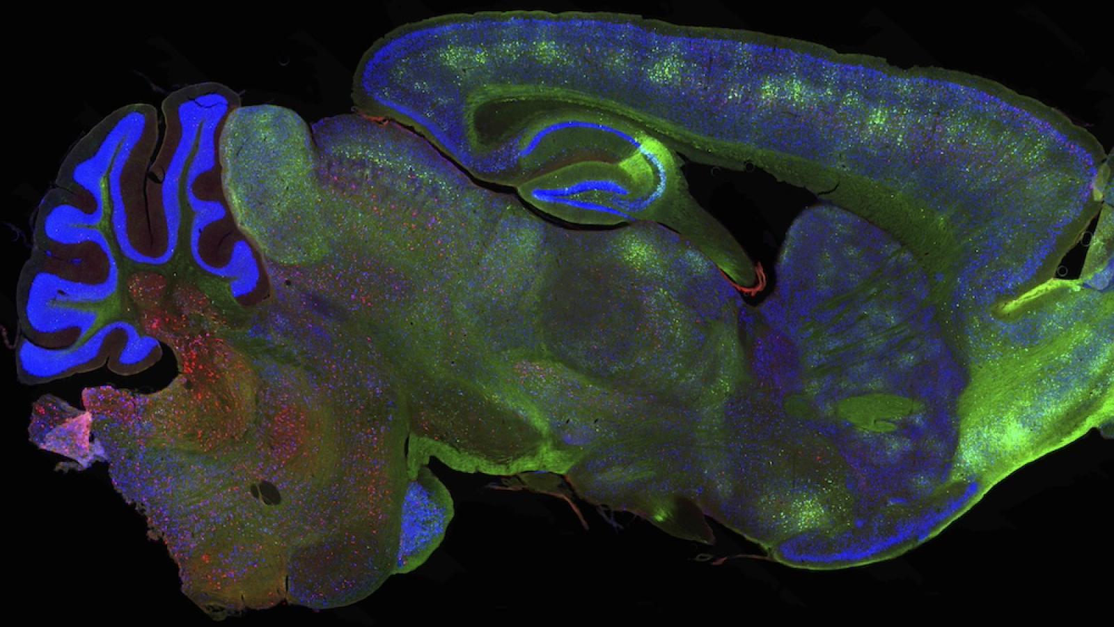 Mouse brain with tau stained