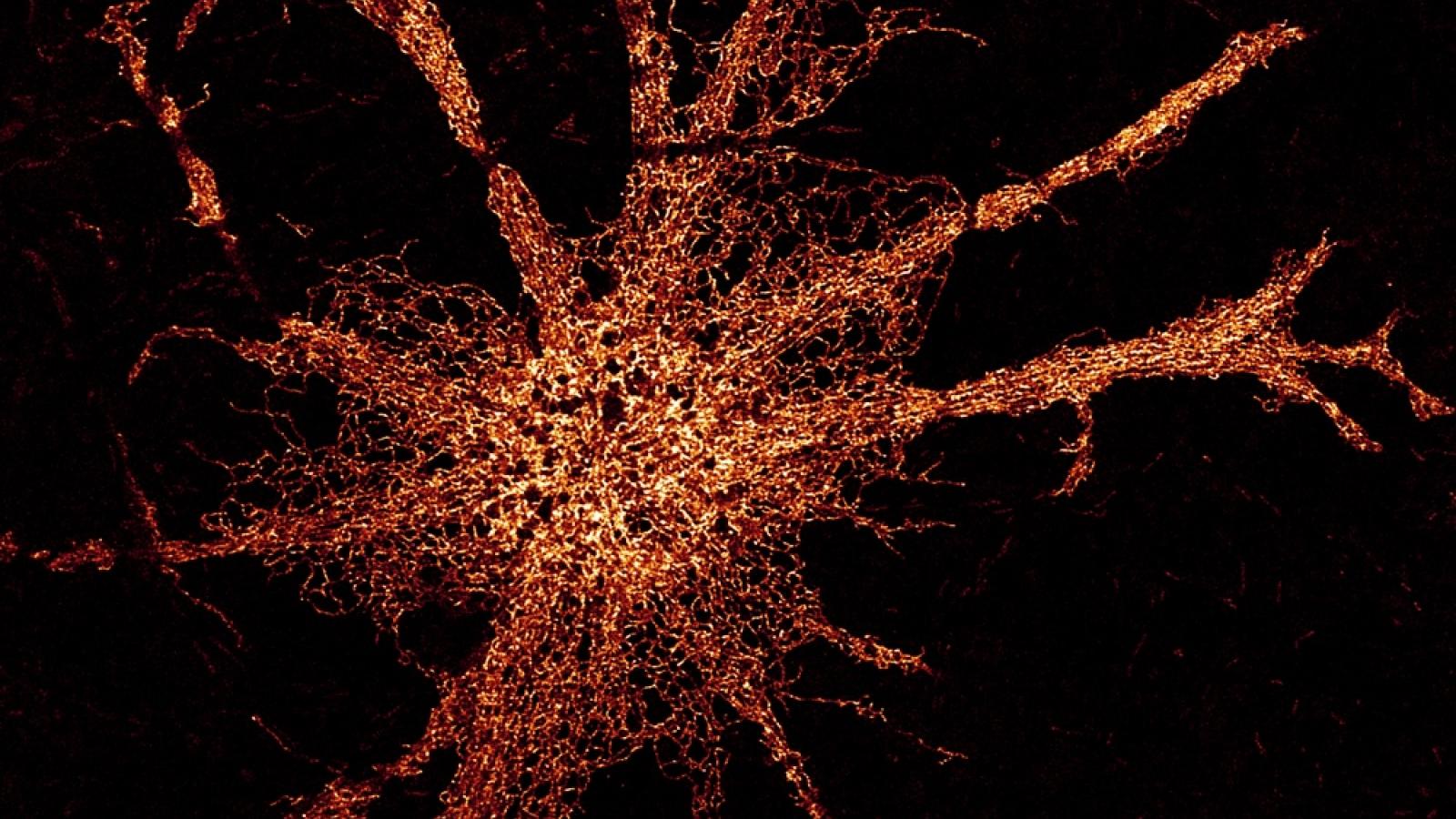 Endoplasmic reticulum stained in Astrocytes