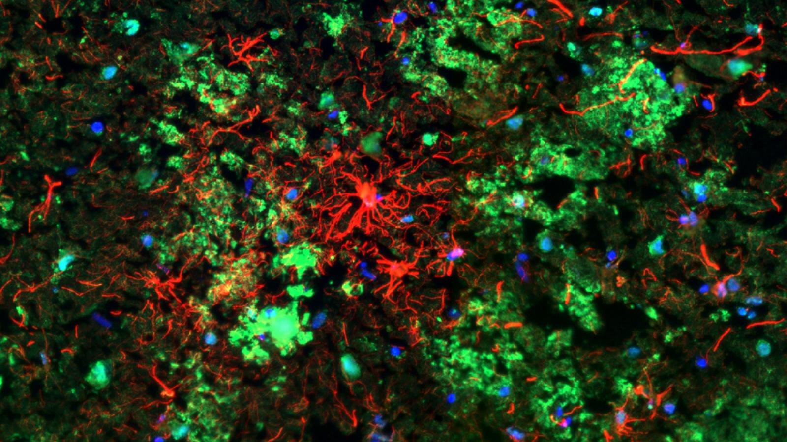 Microglia and astrocyte cells