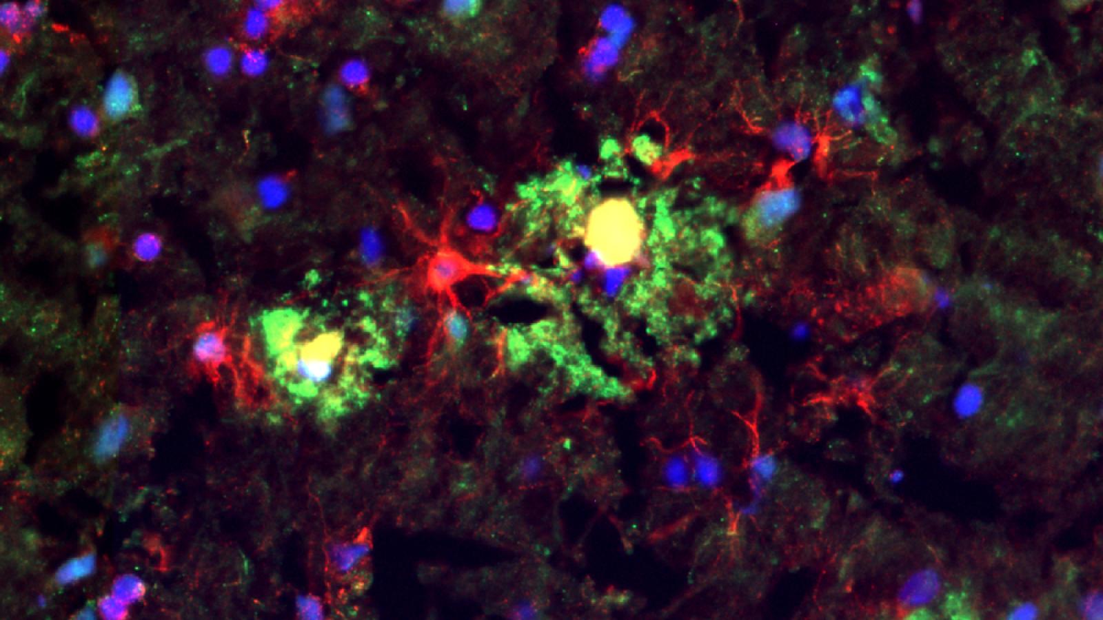 Microglia and astrocyte cells