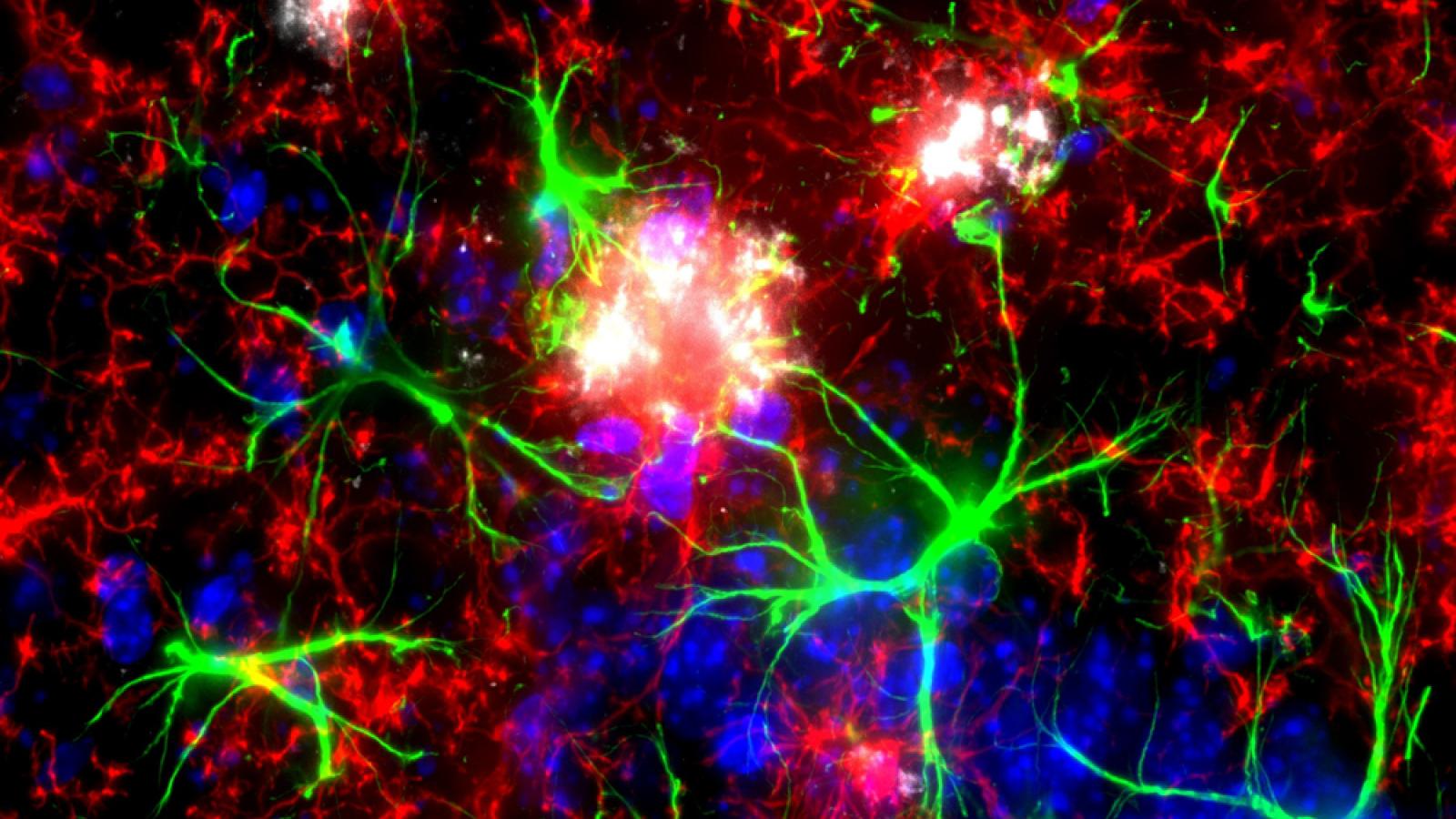 Microglia and astrocytes around amyloid plaque