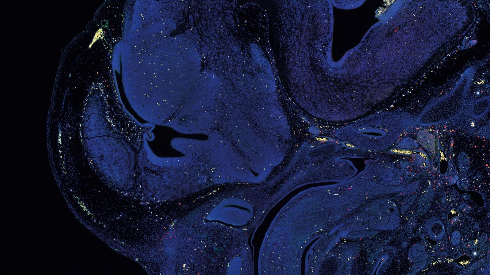 A slice of brain tissue stained with a blue marker