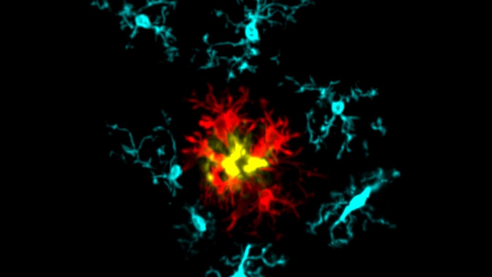 Microglia around an amyloid plaque