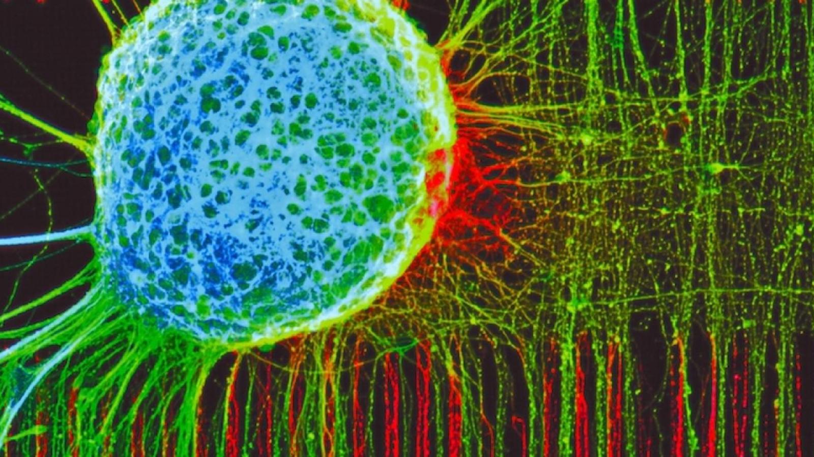 A sphere of neurons