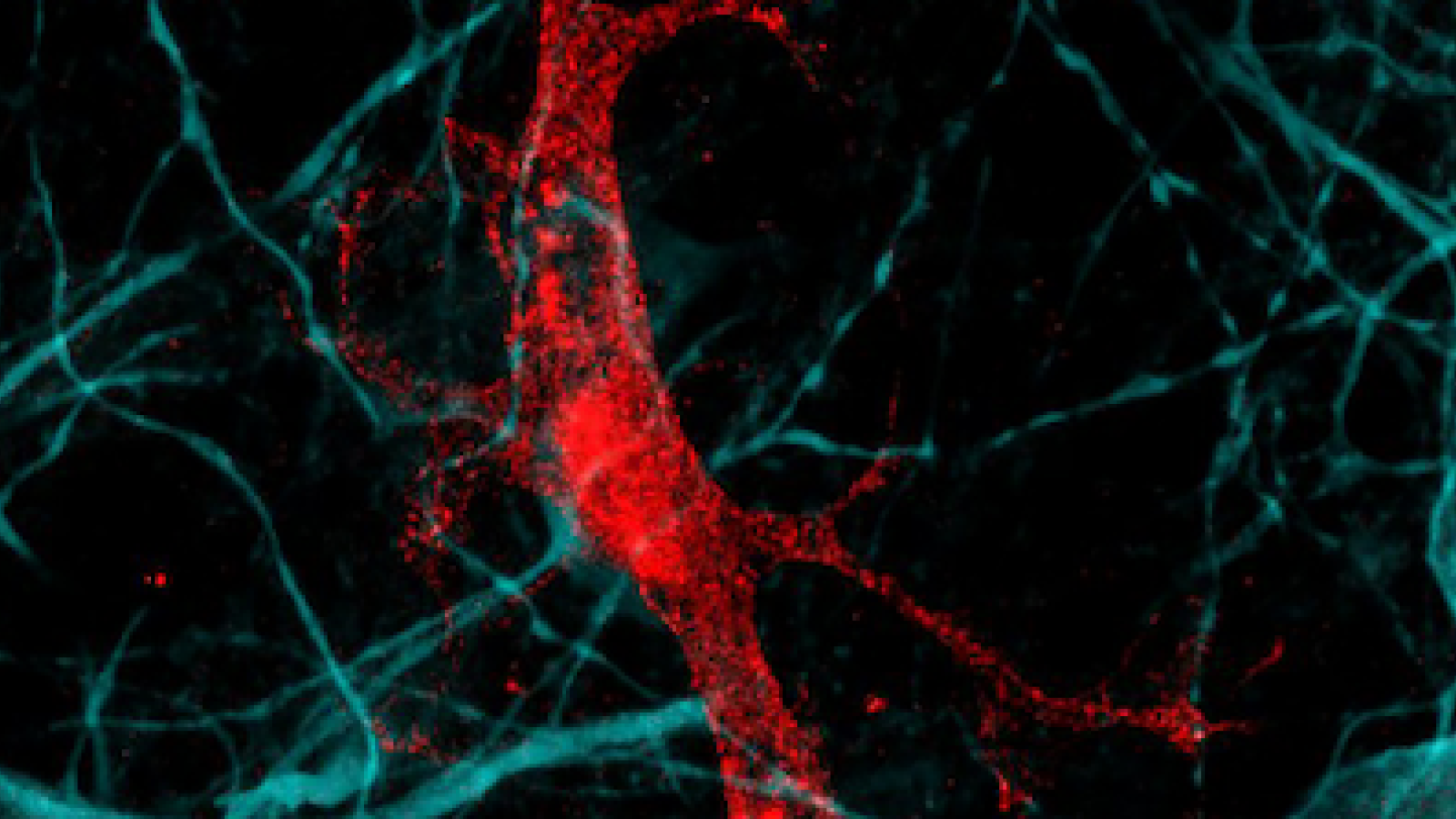 MS Neuroimmunology banner