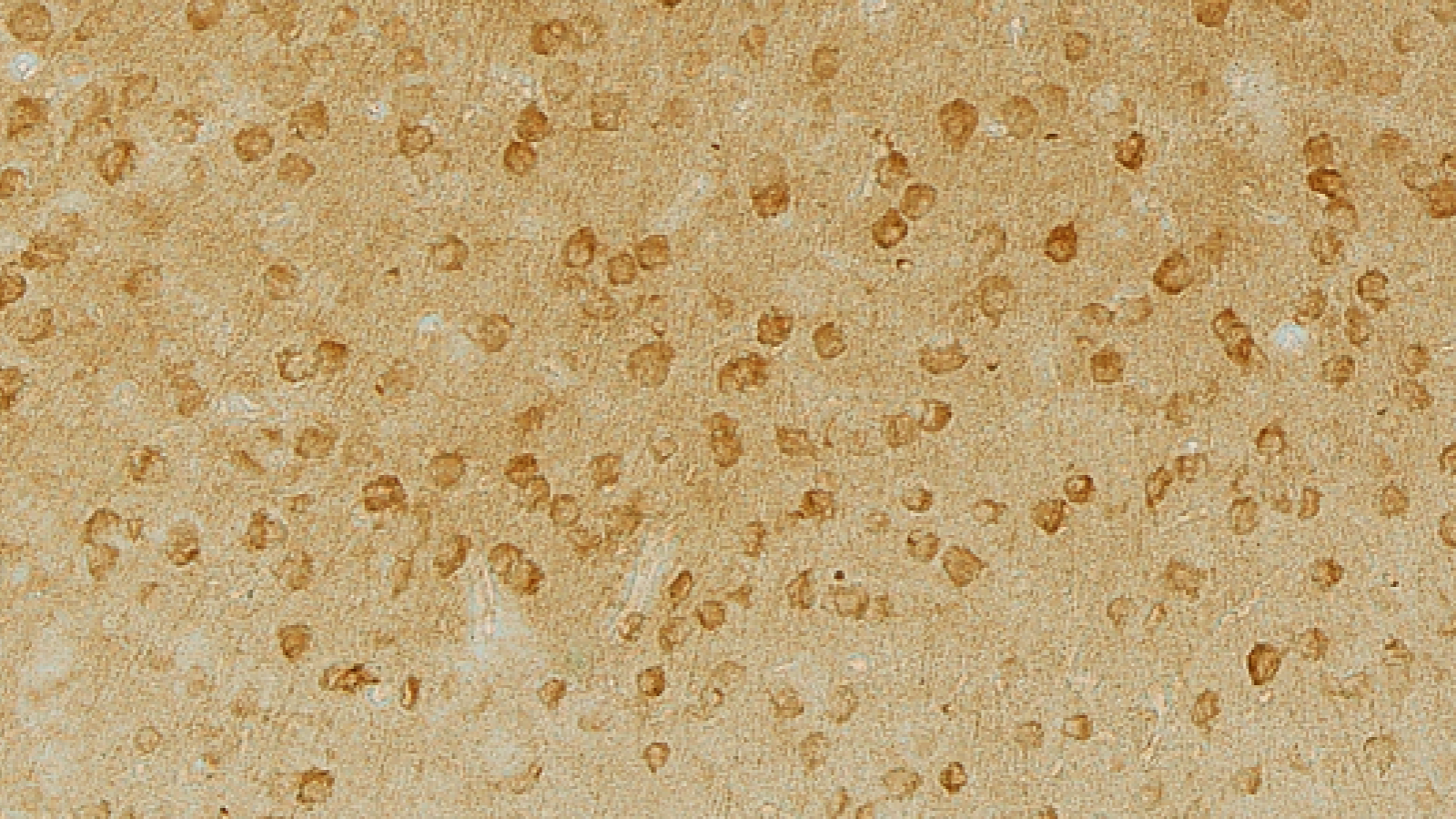 Phospho-tau accumulation in MAPT knockout mice