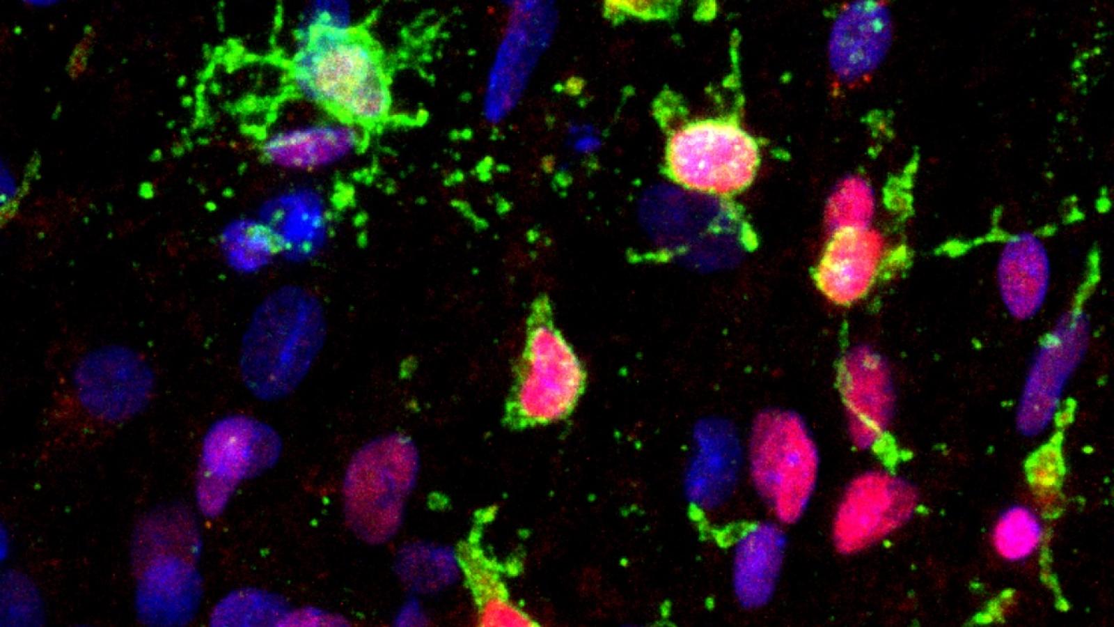 Human oligodendrocytes in a dish (green) produce the amyloid beta protein which is implicated in Alzheimer's.