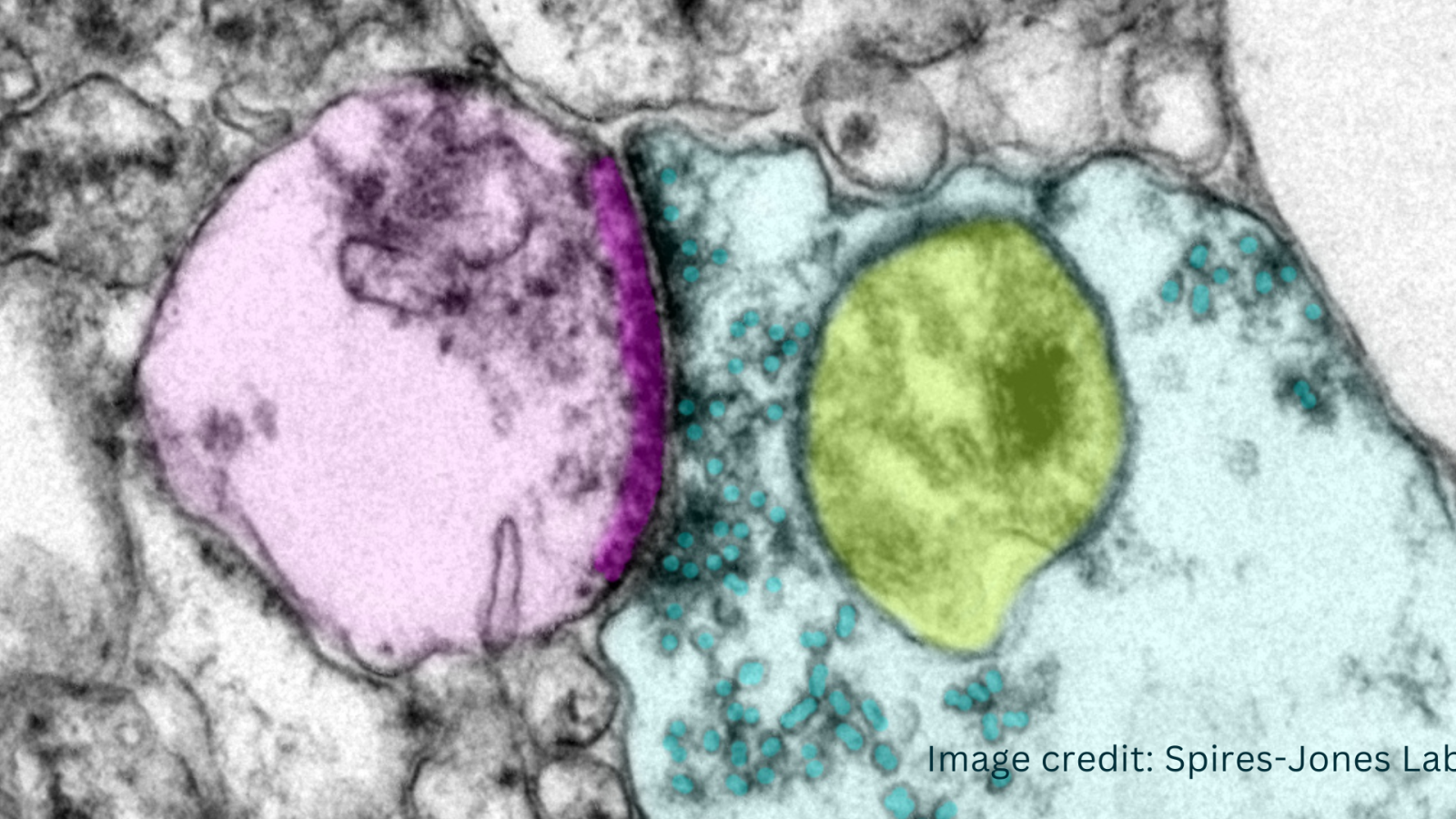 Dementia Masterclass banner neuron image