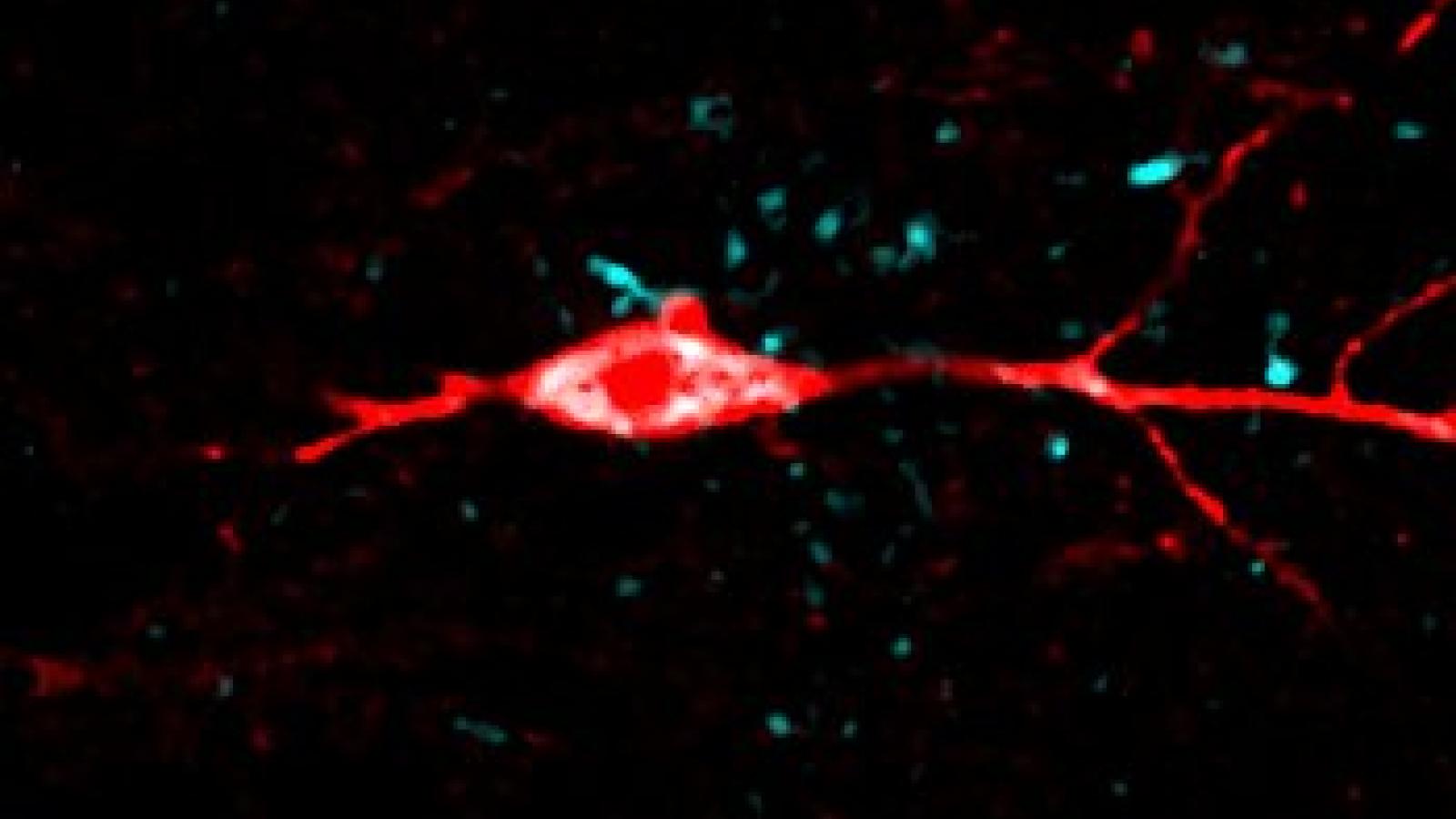 Hippocampal neuron filled with tau