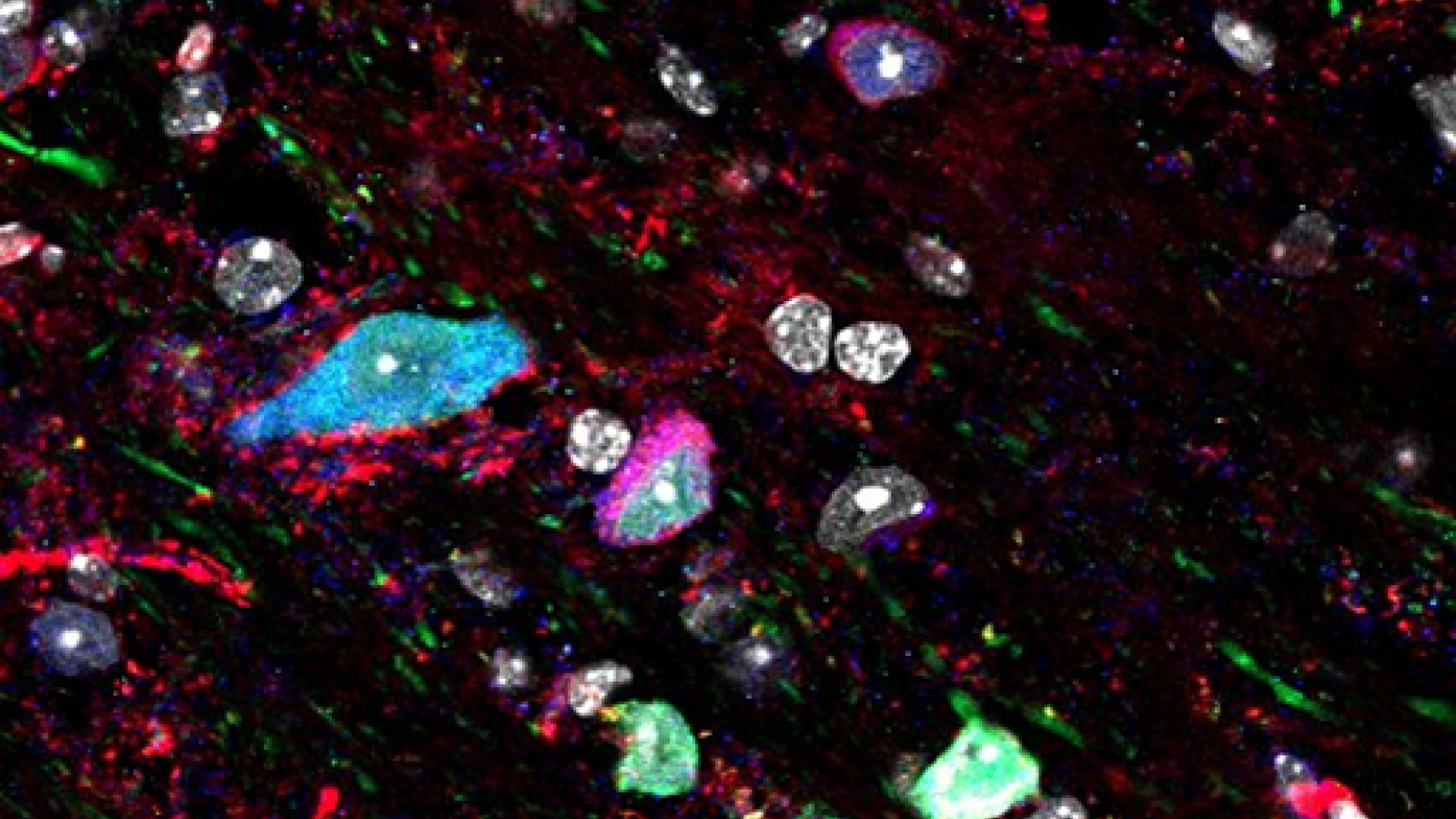 Interneurons expressing GluA4 in deep cortical layers of a mouse brain. 