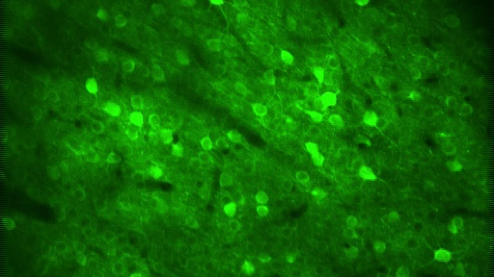 Neurons in the cerebral cortex