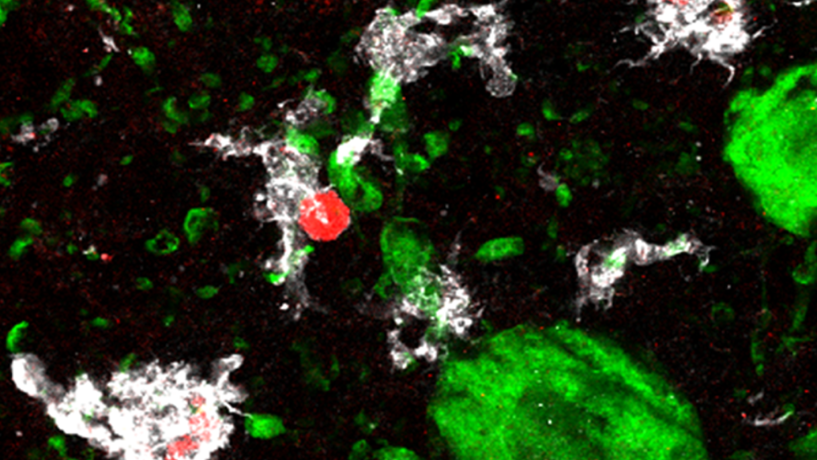 Immune upregulation in rats exposed to rotenone