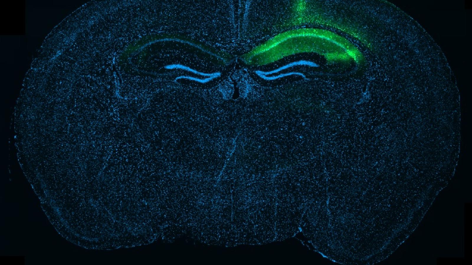 Whole-brain section showing local tau expression in the hippocampus