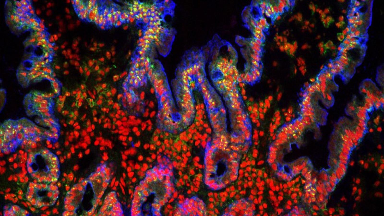 villie-from-small-intestine S. Schuller. Source: Wellcome Collection.