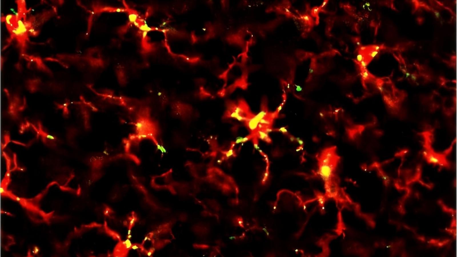 Microglia, the brain's immune cells after ultrasound treatment. Credit- Sarina Grewal, Morse Lab, Imperial College London.jpg