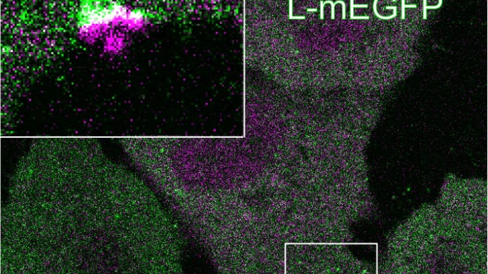 Sequential recruitment of ANXA11-mCh (magenta) and CHMP2B-L-mEGFP (green) to sites of plasma membrane damage