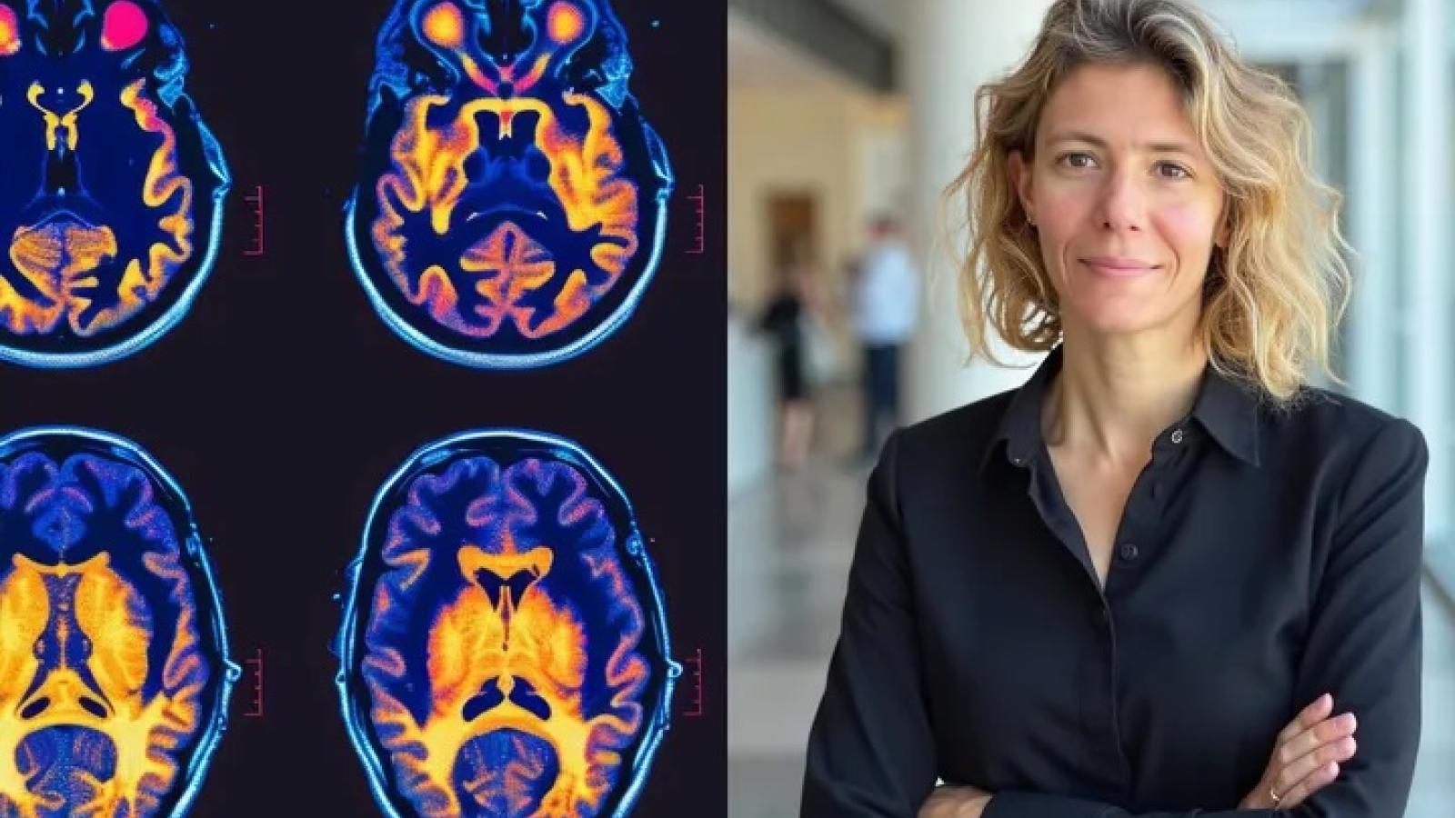 Cynthia Sandor - brain scan image
