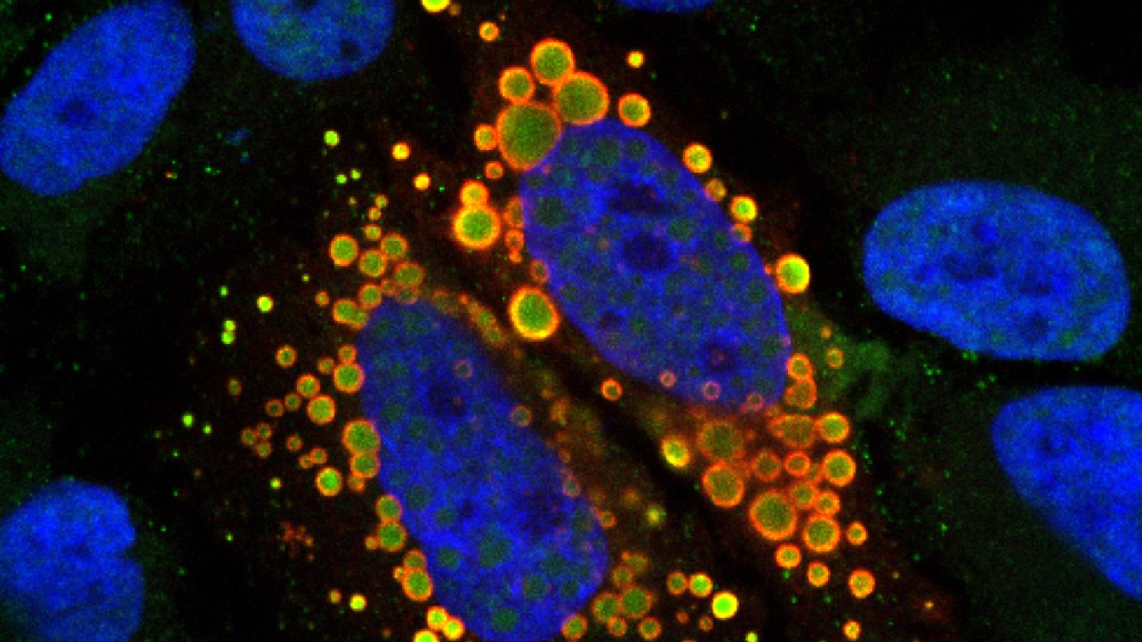 Mutant TAF15 engulfs small nuclear RNAs - Tatjana Zoller