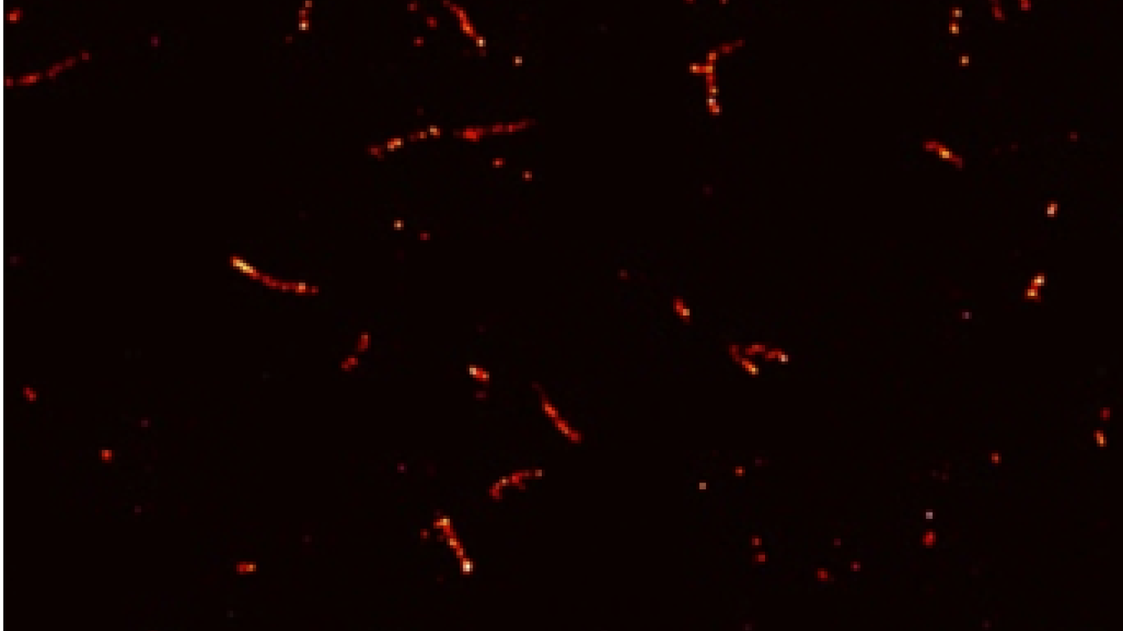 Tiny clumps of tau protein, known as aggregates, visualised using super-resolution microscopy to reveal their different sizes and shapes