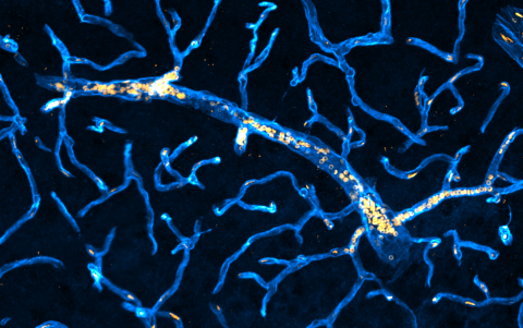 Congestions Montagne Lab