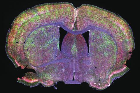 Fluorescence to label different cells and structures of a brain