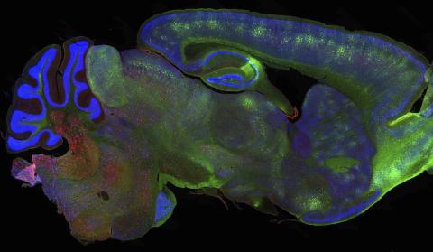 Mouse brain with tau stained