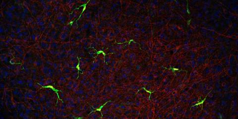 How cells called microglia (red and cyan) respond to problems in the brain