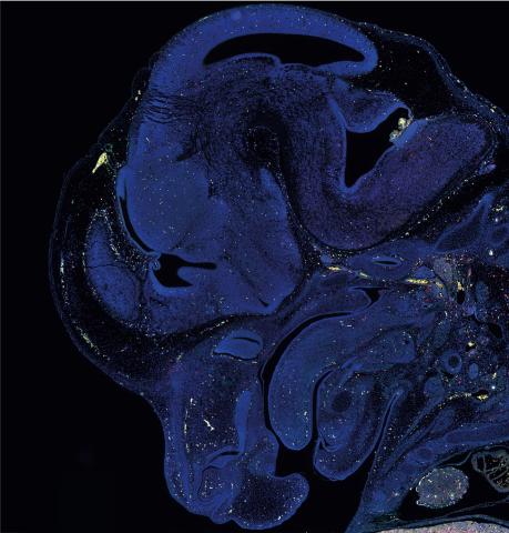 A slice of brain tissue stained with a blue marker