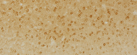 Phospho-tau accumulation in MAPT knockout mice