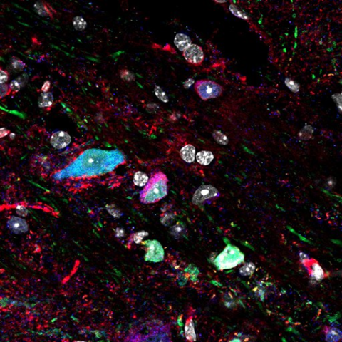 Interneurons expressing GluA4 in deep cortical layers of a mouse brain.